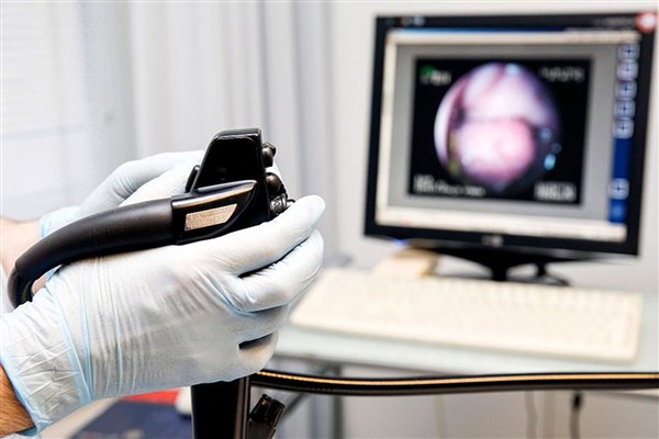 Ендоскопія